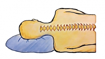Neck Pain
